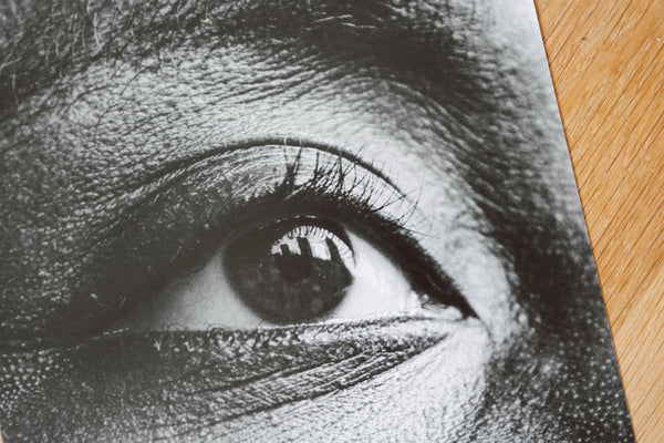 Eye