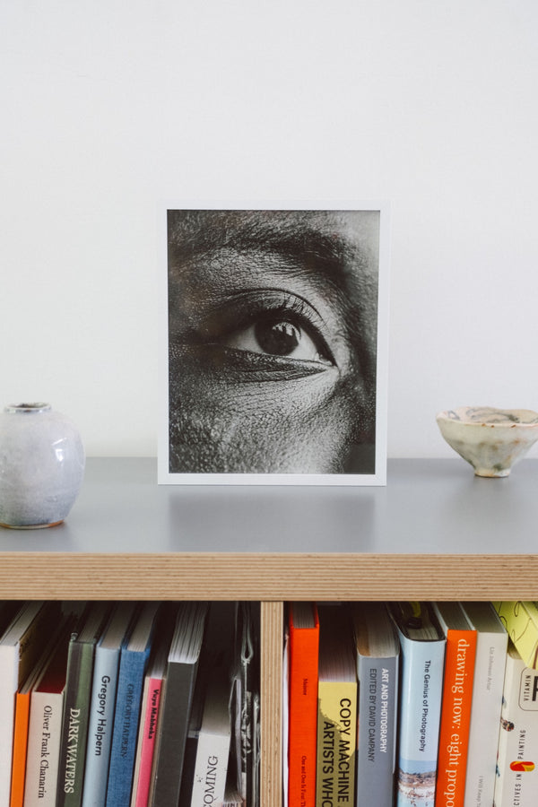 Eye